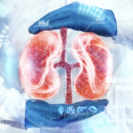 Extreme Heat Is Harming Your Kidneys — Experts Warn